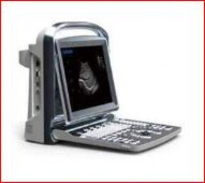 Chison ECO1 Ultrasound