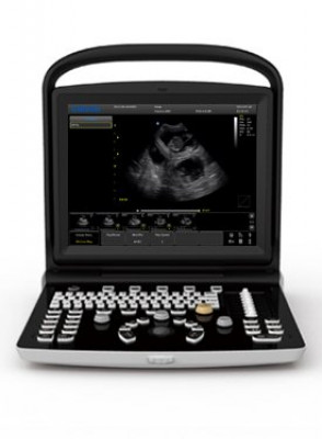 Chison ECO3 Vet Ultrasound