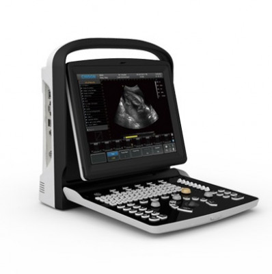 Chison ECO3 Ultrasound