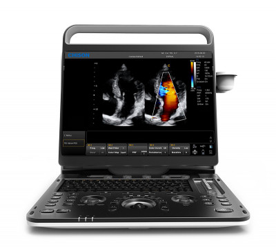 Chison Ebit 60 Ultrasound