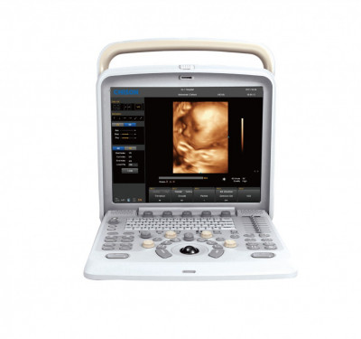 Chison Q5 Ultrasound