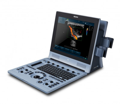 Edan U60 Ultrasound