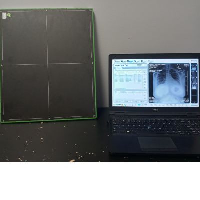 ExamVue Duo 14” x 17” Wireless Digital Panel