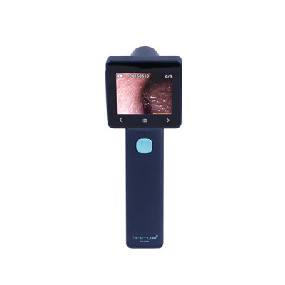 Ezer EZ-Horus OTO Blue Digital Otoscope