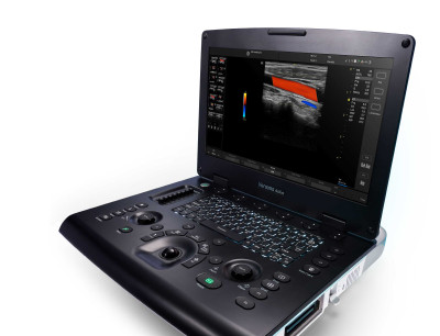 GE Healthcare – Versana Active – Portable Ultrasound System (Console Only, Add Your Probes)