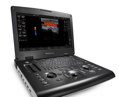 GE Healthcare – Versana Active – Portable Ultrasound System with 2 probes GE 4C-RS curved & GE L6-12-RS linear