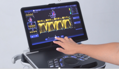 GE Vivid IQ Standard Ultra Edition