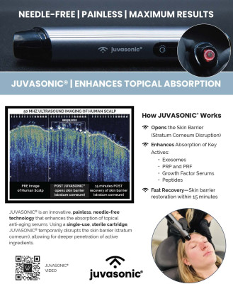 JUVASONIC® Dermis abrasion allowing for product absorption