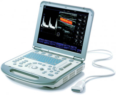 Mindray M5 Ultrasound