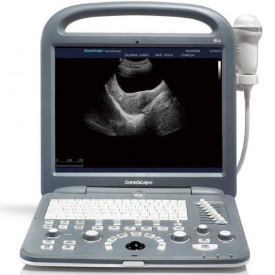 SonoScape S2 Ultrasound