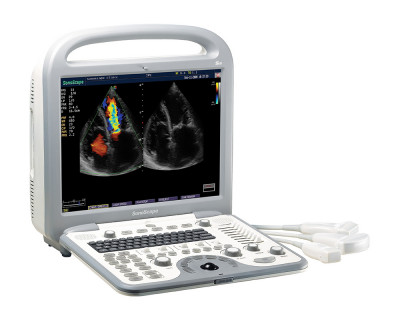 SonoScape S8 Ultrasound