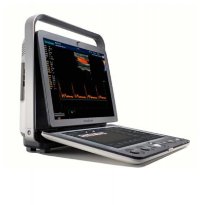 SonoScape S9 Ultrasound