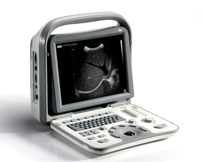 Sonoscape A6 Ultrasound