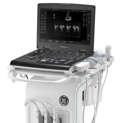 GE Healthcare – Versana Active – Portable Ultrasound System with GE L6-12-RS Linear Probe