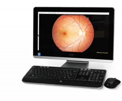 Burton RetinoVue Imaging System