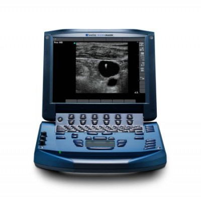 Sonosite MicroMaxx Ultrasound
