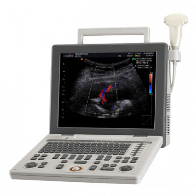 Samsung Medison SonoAce R3 Ultrasound